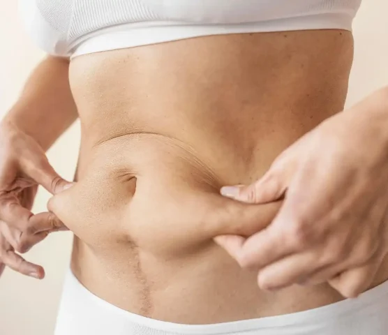 close-up-hands-holding-belly (1)